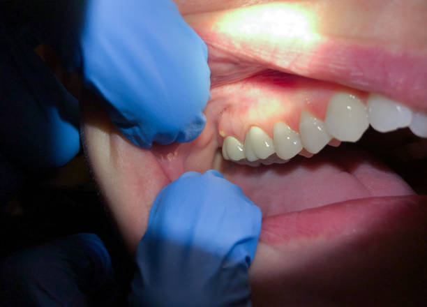 Best Emergency Dental Surgery in Mountlake Terrace, WA