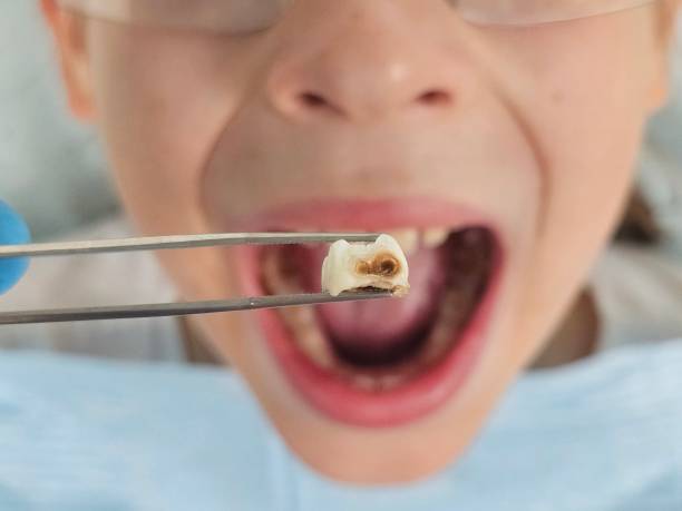 Best Emergency Dental Care for Trauma or Injury in Mountlake Terrace, WA